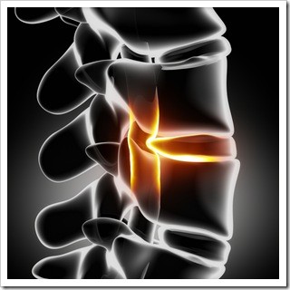 Slipped Disc Jackson MS